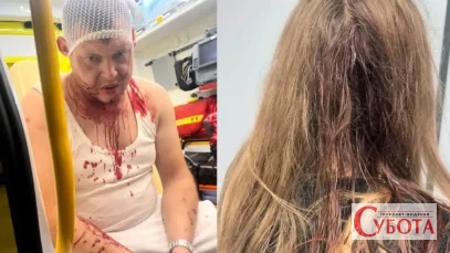 У Польщі знову побили трьох українців після суперечки через музику