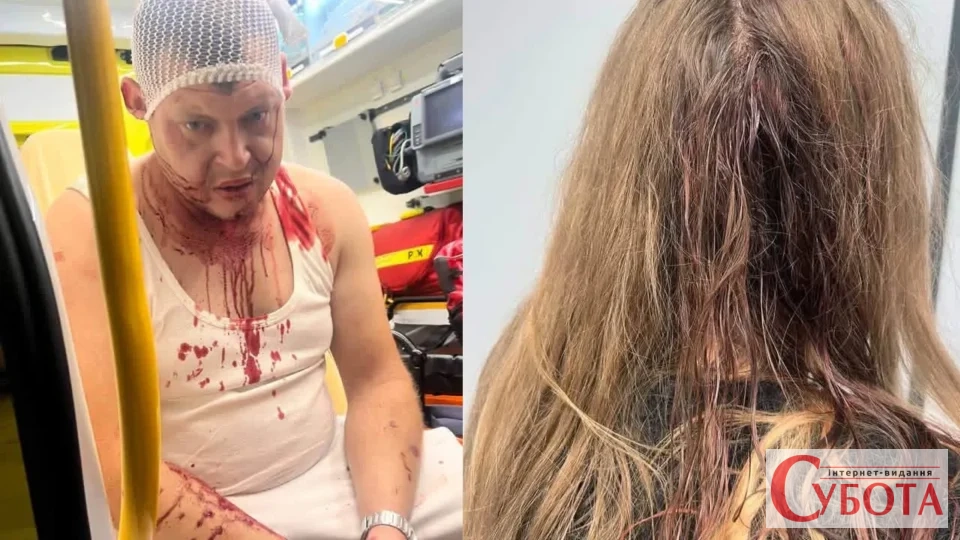 У Польщі знову побили трьох українців після суперечки через музику