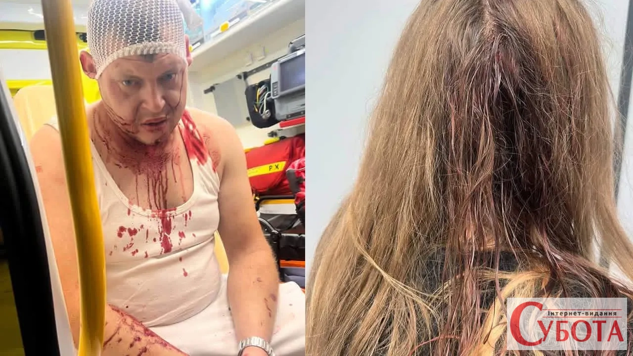 У Польщі знову побили трьох українців після суперечки через музику