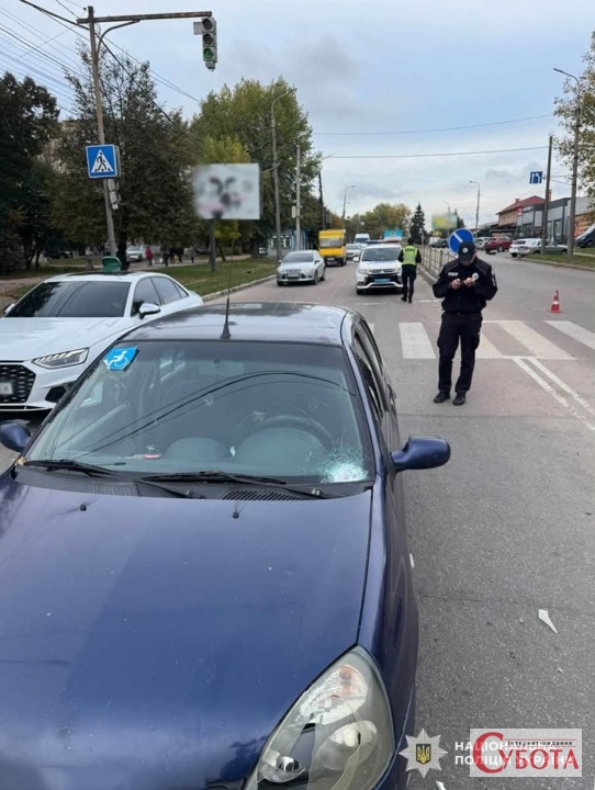 На Житомирщині під колеса Renault потрапила 55-річна жінка: потерпілу госпіталізували — фото 2